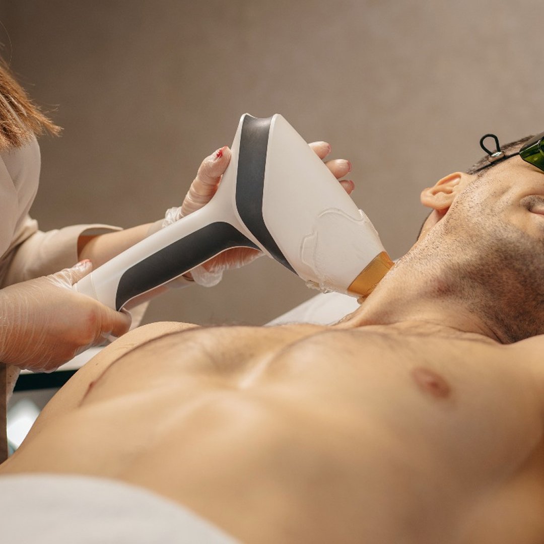 SH_epilazione_laser_uomo 1