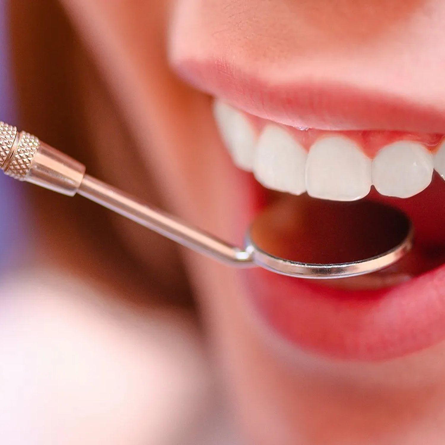 how-long-filling-last 1 (1)