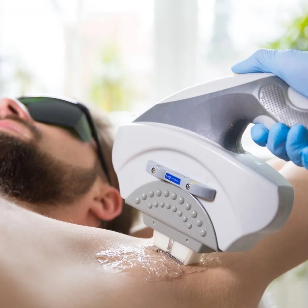 laser-hair-removal 1